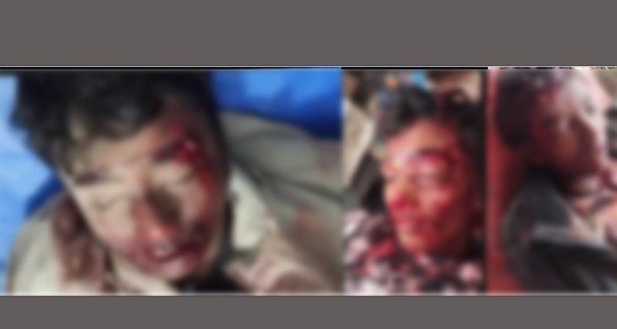 দৌলতপুরে সড়ক দুর্ঘটনায় ৩ শিক্ষার্থীর মৃত্যু